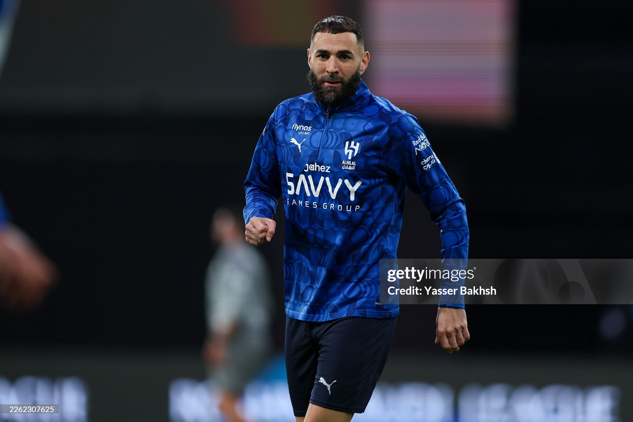 Karim Benzema jarohat oldi