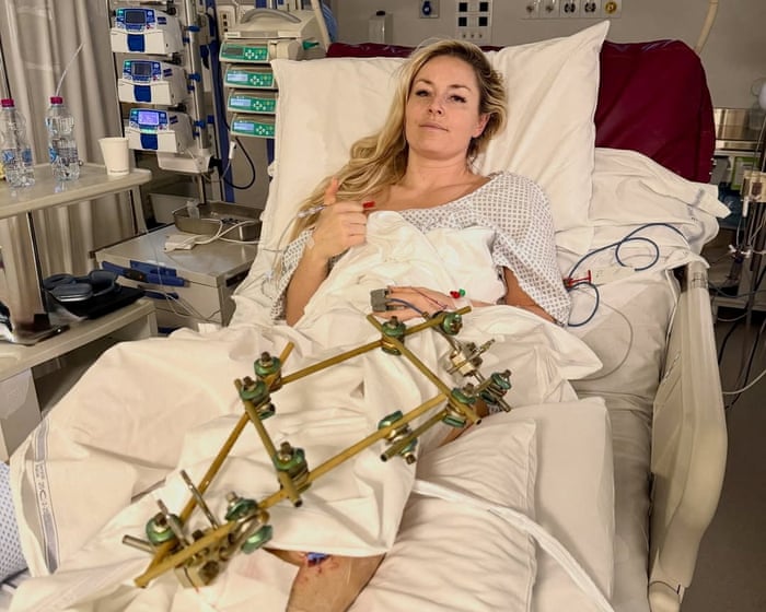 Lindsey Vonn Undergoes Successful Surgery